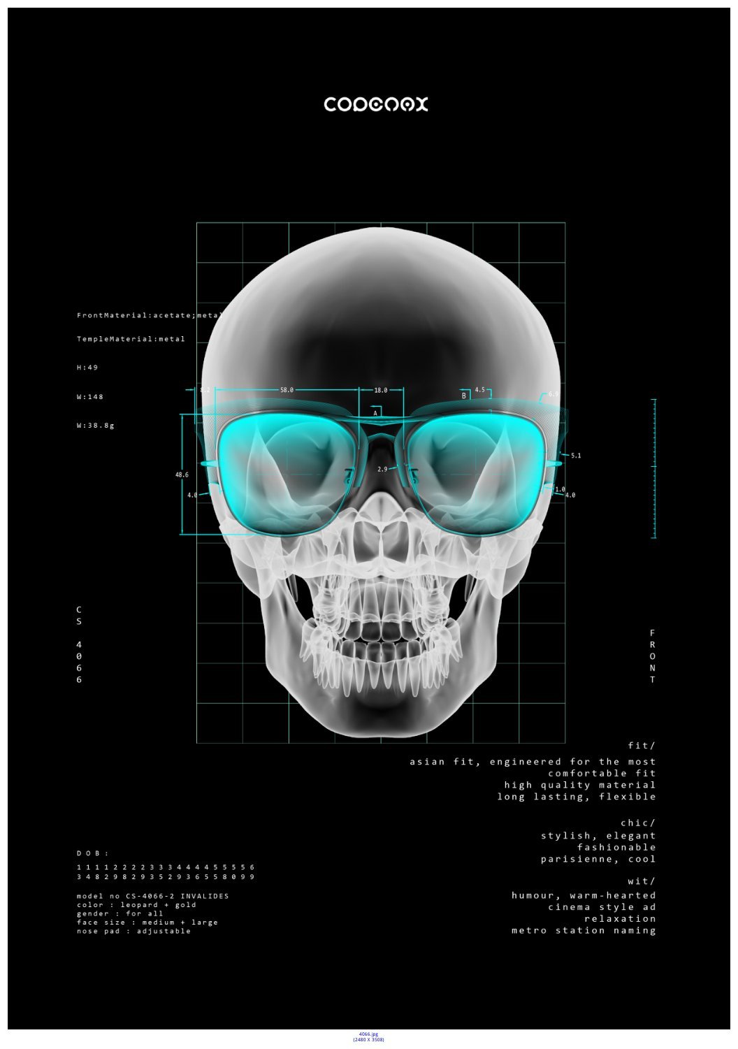 X-RAY